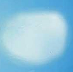 Renk Atması - Kusma